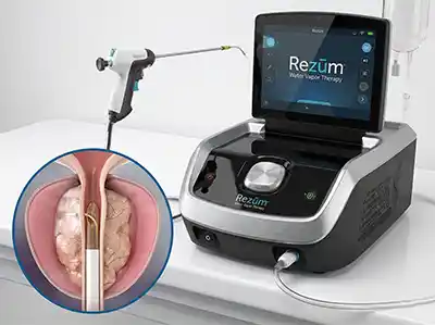 ReZUM Procedure